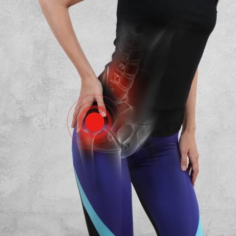Woman,With,Hip,Joint,Pain.,Sport,Exercising,Injury